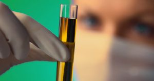 Lee más sobre el artículo Un grupo de proteínas permite predecir el riesgo de recaída en pacientes con cáncer del pulmón