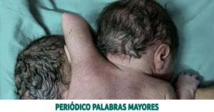 Lee más sobre el artículo NACE BEBÉ CON TRES MANOS, DOS CORAZONES Y DOS CABEZAS CUANDO ESPERABAN MELLIZOS